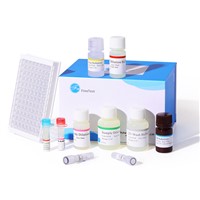 Human IL-1b(Interleukin 1 Beta) ELISA Kit